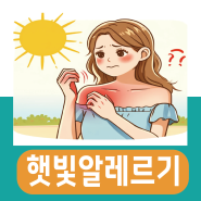 햇빛 알레르기 증상 원인 병원 연고 치료 방법