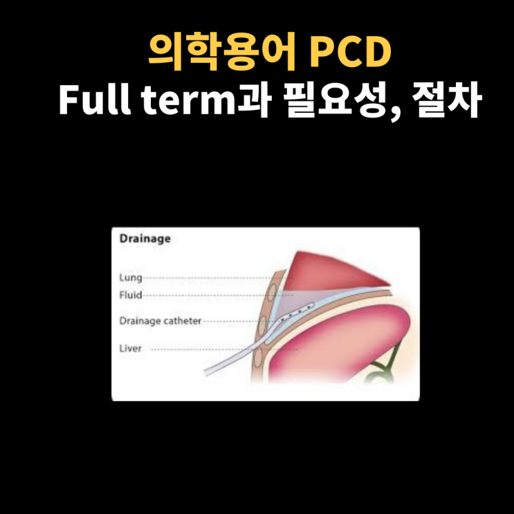 의학용어 PCD 뜻과 무엇인지, 왜 시행하는지, 준비사항에 대해 알아봐요~ : 네이버 블로그