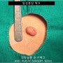 엉덩이 쥐젖 :: '연성섬유종/섬유상피용종' 제거 사례 【Dr. 아베크 양성종양】