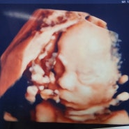 임신 28주, 7개월 입체초음파검사 비용 실물과 얼굴 비교