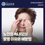 노인성 녹내장의 발병 이유와 예방법