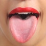 혀백태제거와 혓바닥 백태로 보는 건강 적신호 부산 전대성 한의원