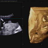 임신 14주 2일 초음파, 성별 확인, 근황 기록