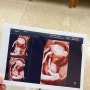 임신일기 #2. 임밍아웃에 1차 기형아 검사 (8주~12주)