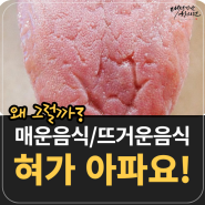 매운걸 먹으면 혀가 화닥화닥 아려요 : 대전 강남한의원