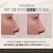 강남 매부리코 휜코교정 비용 유투성형외과 알아봐요