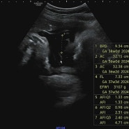 [임신일기] 38주차 산부인과 진료(출산 전 마지막 검사, 유도분만 확정)