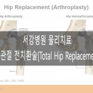 서강병원 물리치료 : 고관절 전치환술 [Total Hip Replacement.THR]