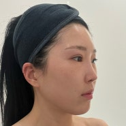 [서울] 가인미가 강남신논현점 : 작은얼굴 경락 후기, 인모드 필요없는 찐 리프팅 관리