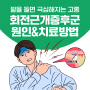 회전근개증후군 원인과 치료방법! 테니스 치다가 회전근개파열? 치료비 수술비 보장받을 수 있을까?