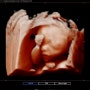 B17. 임신 20-21주차 일상 및 증상 - 젠더리빌파티+20주 정밀초음파