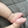 이소성 몽고반점:아기 발목 푸른 점