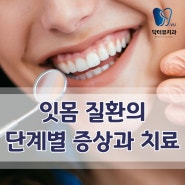 가능역 치과 잇몸질환의 단계별 증상과 치료