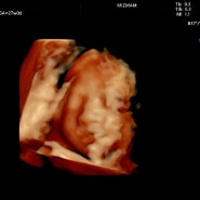 [임신기록] 5. 임신17주~임신29주 (정밀초음파, 임당검사, 얼굴 입체초음파)