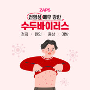 전염성 매우 강한 수두바이러스 정의 원인 증상 예방