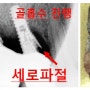 밤섬이치과에서 추구하는 임플란트란? _광흥창 밤섬이치과