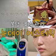 봉담피부관리는 뉴데이에스테틱에서! feat. 민감성 피부엔 버블케어