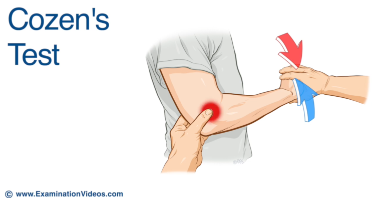 팔꿈치 관련 손상 검사(Elbow special test)-Cozen test,Reverse Cozen test,Varus ...