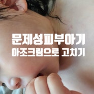 아기 문제성피부 아조크림으로 고치기 6주차 (병원에서 칭찬받은 후기)