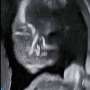 [임신일기] 22주. 2차 정밀초음파 / 6개월 임산부 캠핑 / 임산부 허리골반통증