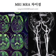 뇌MRI MRA 차이점 뇌MRA MRI검사시간 비용 발견가능질환!