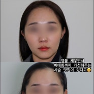 안면비대칭 피부과? '이것' 먼저 확인하고 가세요