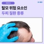 두피 질환, 방치하면 탈모로 이어질 수 있어요! 하이모가 알려주는 두피 질환 종류!