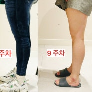 [9주차] 인천지방분해주사, 구월동 허벅지다이어트 두달만에 8kg 감량!