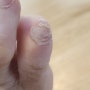 [아쌈의 리뷰]마유크림 효능과 손발톱 무좀 ,습진 부터 피부보습에 부작용