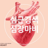 심근경색 심장마비 대처와 예방법