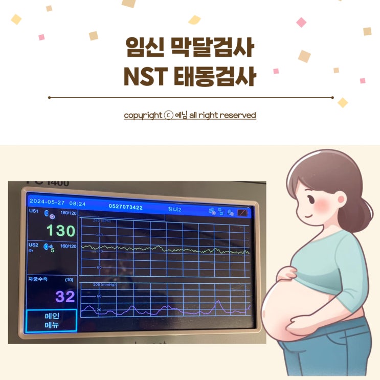 임신 막달검사 임산부 NST 태동검사 시기 비용 : 네이버 블로그