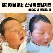 청라여성병원 신생아 황달입원치료 후기(황달수치, 광선치료, 퇴원 후 약처방)