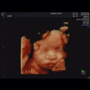 [임신기록 24주~27주]임당검사, 정밀초음파, 입체초음파