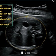 임신 30주차(30주4일) 정기검진