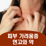 피부가려움증치료 : 연고와 피부 가려움증 약