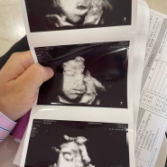 [임신일기] 29~30주차, 임신후기 다양한 증상들, 30주 아기 초음파