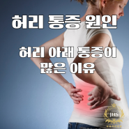 허리 통증 원인: 허리 아래 통증이 많은 이유