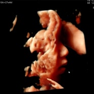 임신 27주 28주 아기 3D 입체초음파 시기 실패 코 입만 봄ㅠ