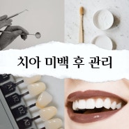 광명동 치과, 치아 미백 후 관리 방법 알려드립니다^^