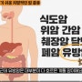 암 폭증하는 진짜 이유- MD앤더슨 종신교수 김의신 박사
