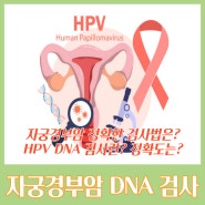 HPV DNA 검사 장단점, 방법과 결과의 정확도는?