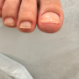 인천 주안 문제성발톱 빛깔난다 디에고푸스 인천주안점 내성발톱 치료후기