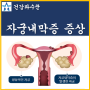 자궁내막증 증상 원인 자궁내막증 진단 치료