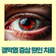눈병 결막염 증상 결막염 원인 치료 관리