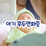 신생아 아기 후두연화증 총정리