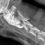 개/강아지 AAI에서 3D printing을 이용한 수술적 치료