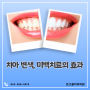 전주치아미백, 치아 변색, 미백치료의 효과