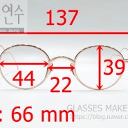 [고도근시안경] 렌즈삽입수술 그리고 제거 후 안경
