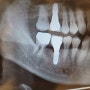 스케일링하러 1년에 한 번 치과. 동인천역앞 단골 치과 젠치과의원 소개합니다.