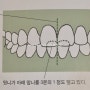 치과 정보] 바르고 건강한 치아배열은? 내 아이의 치아 배열 상태자가체크하기
